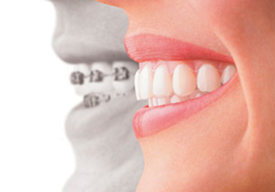 ortodonti_1_.jpg